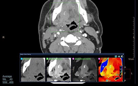 spectral ct video