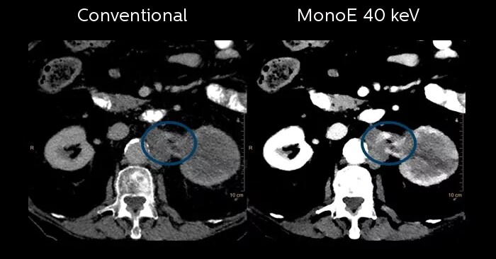 Diagnostic CT