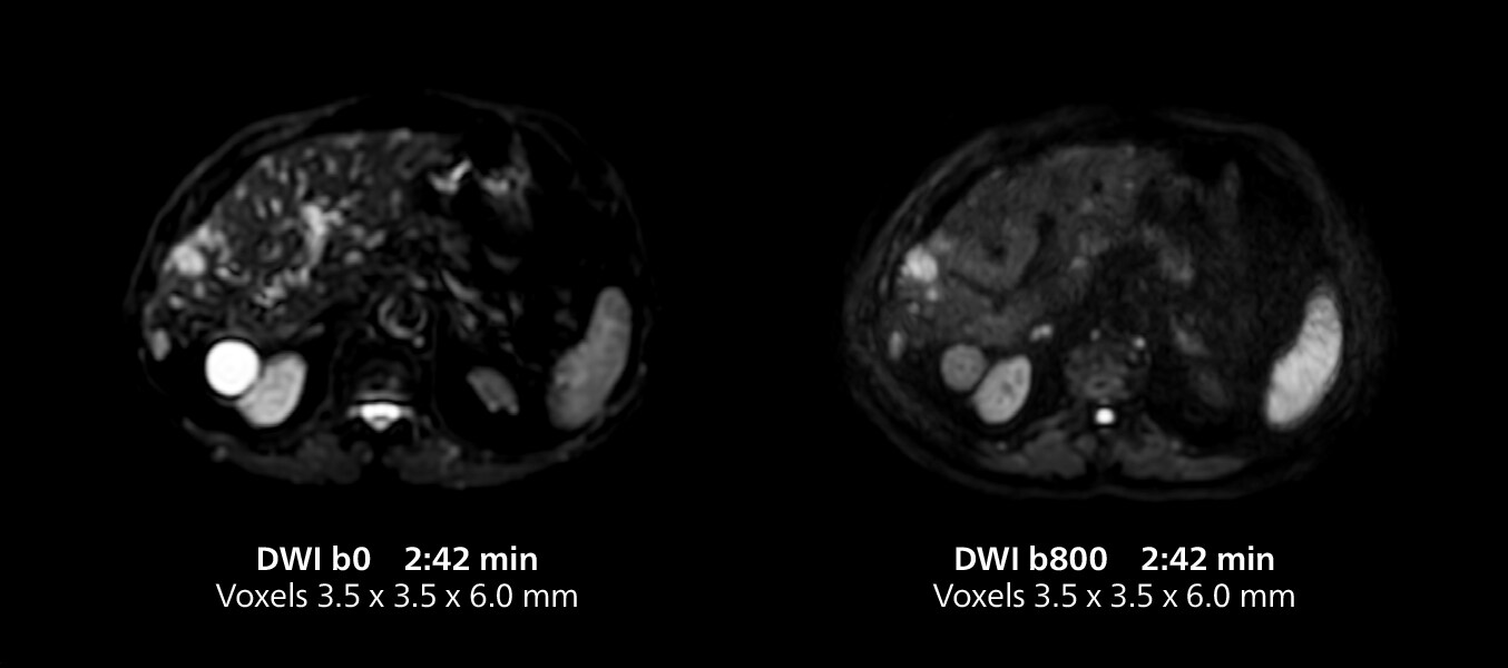 Knee mri three