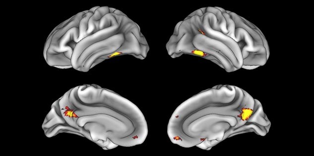 MultiBand SENSE fMRI faces vs places cortex