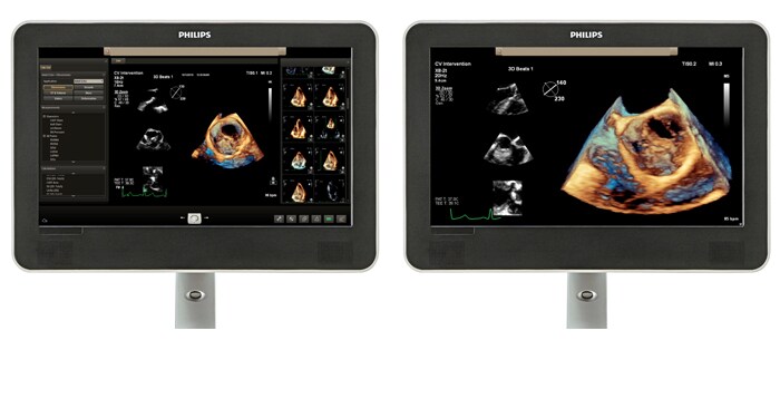 Viewing area comparison with a cardiology ultrasound image on screen.