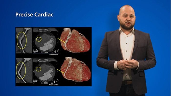 Cardiac CT video thumb