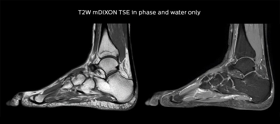 Lefebvre Case Ankle 960px