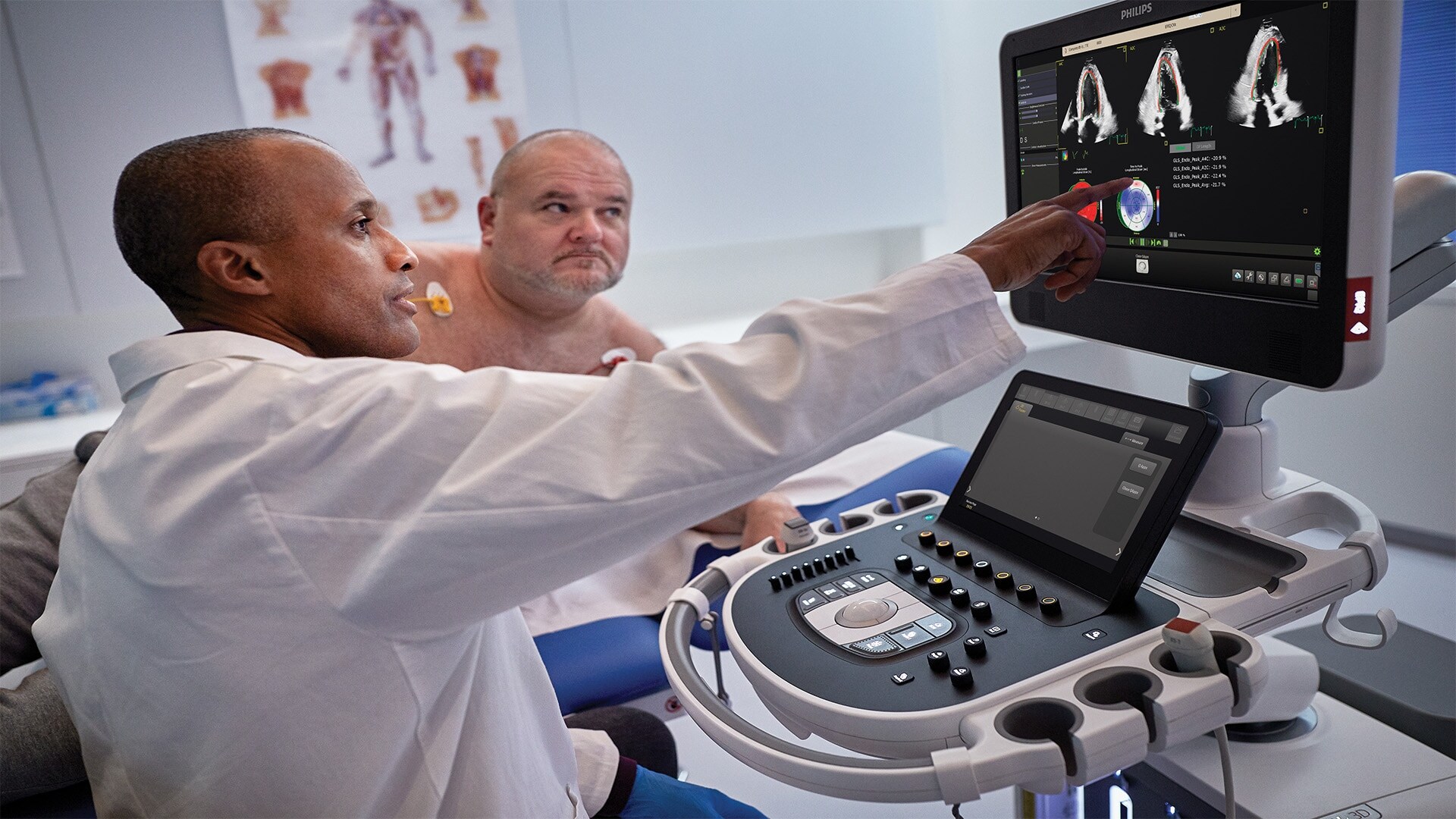 AI-enabled cardiovascular ultrasound platform
