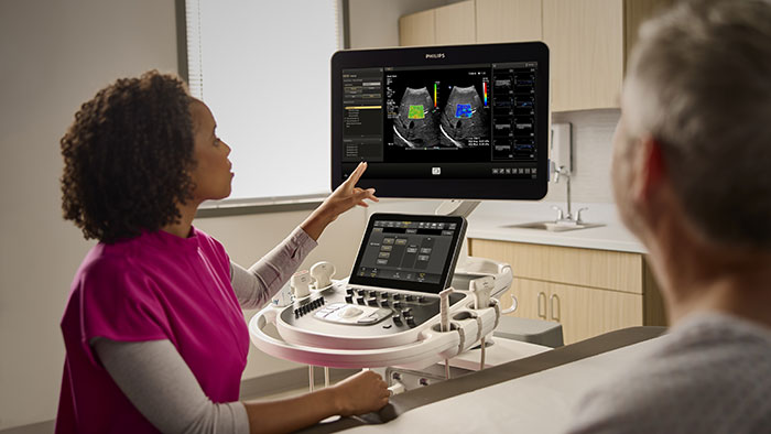 : New automated workflow and quantitative measurement functions in ultrasound speed exams and increase clinical confidence