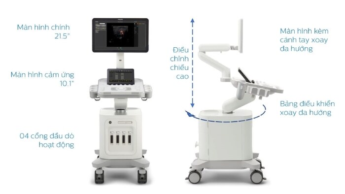 ultrasound system