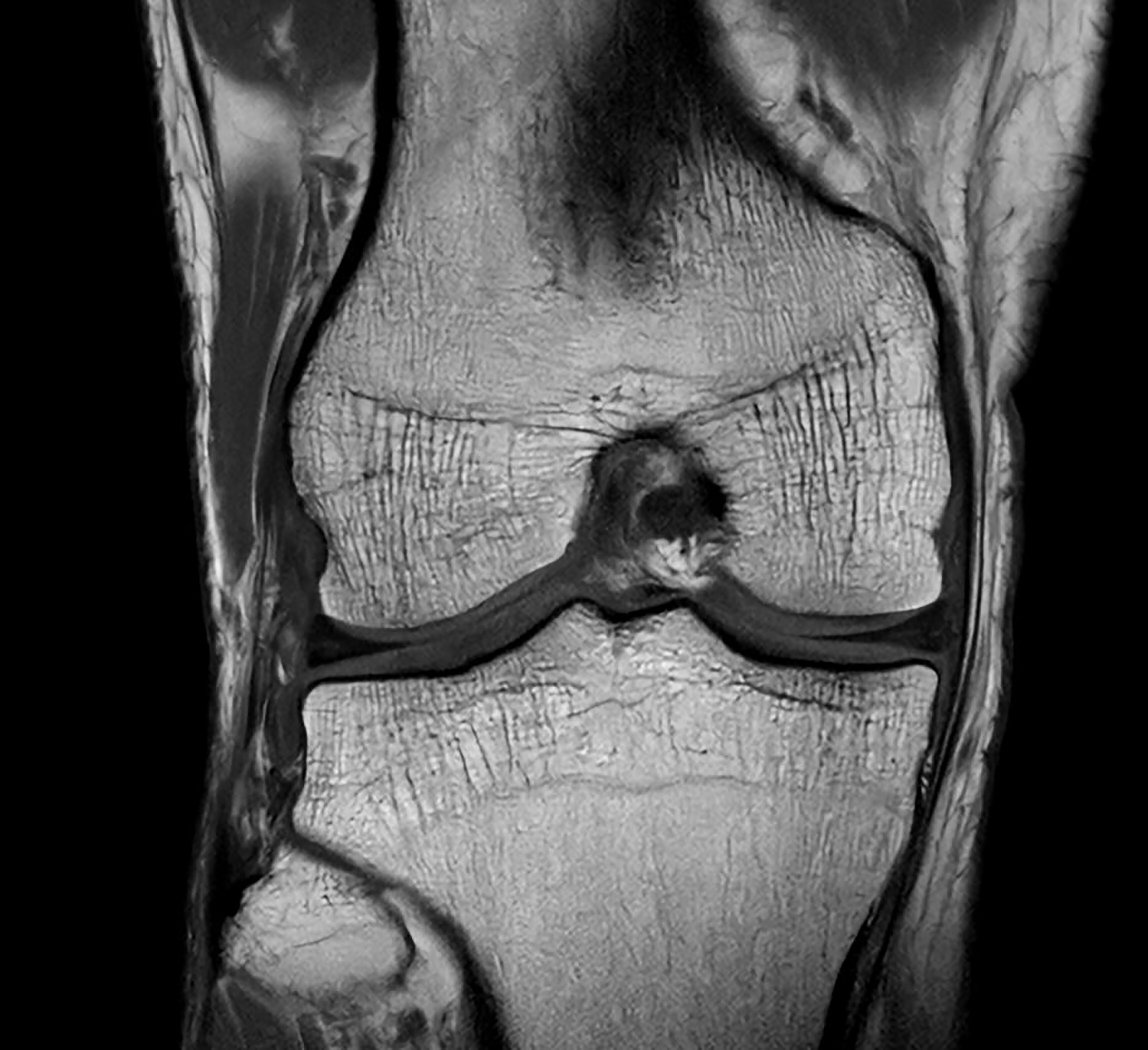 smartspeed precise knee ingenia elition 3 0t asset3